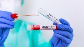 TEST-CORONAVIRUS-COVID-19-2560×1280