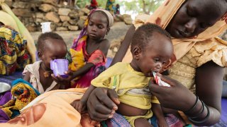 MALNUTRITION–AU–MALI